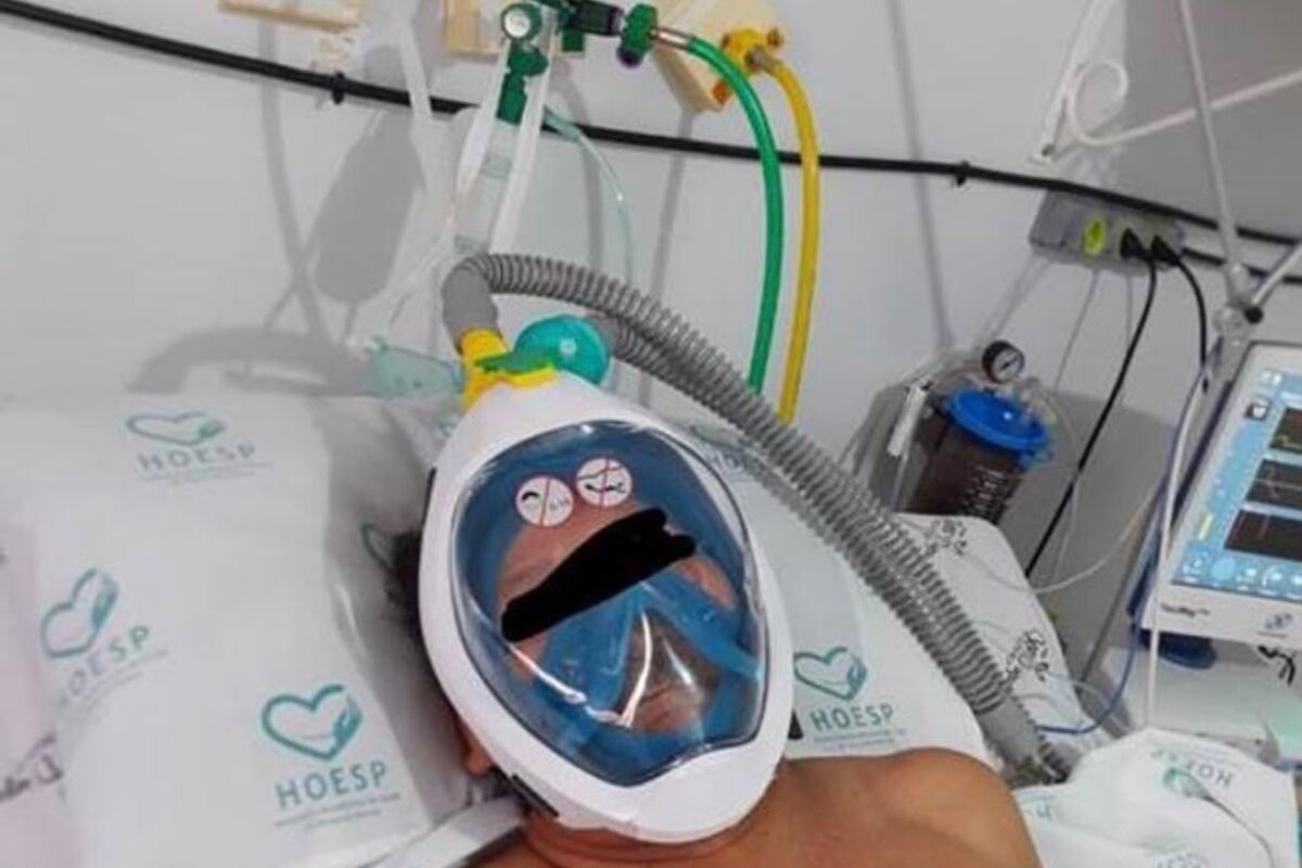 Maschera Easybreath adattata a respiratore in un ospedale in Brasile